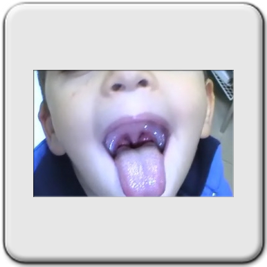 La gola di Alex (cliccare sulla foto per ingrandire)